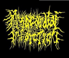 Myocardial Infarction